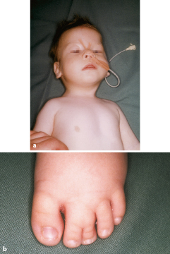 graphic file with name 978-3-662-57295-5_3_Fig14_HTML.jpg