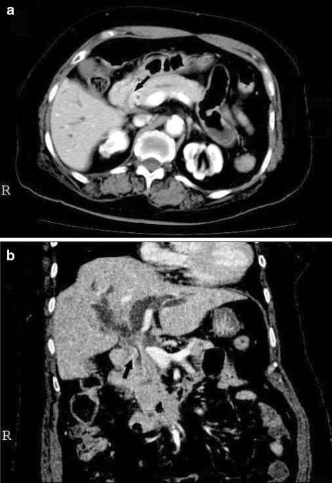 Fig. 1