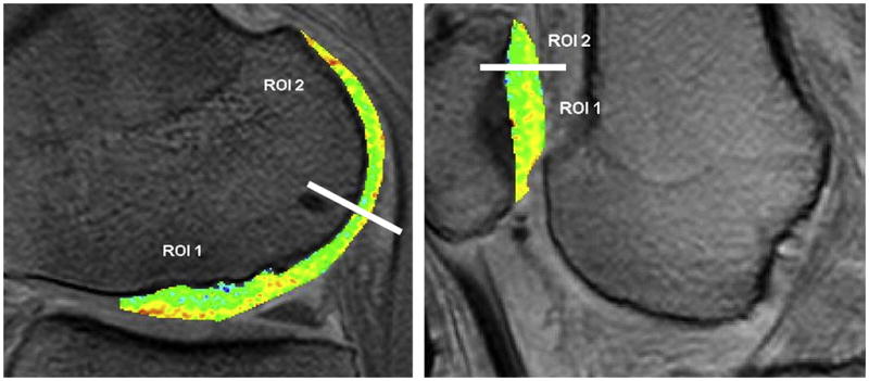 Figure 17