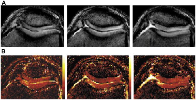 Figure 31