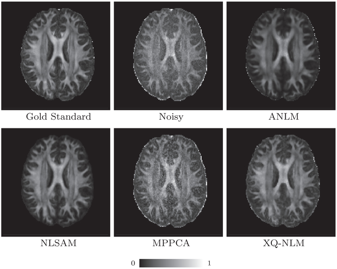 Fig. 14.