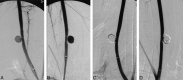 <sc>fig</sc> 2.