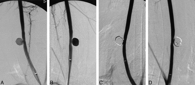 fig 2.