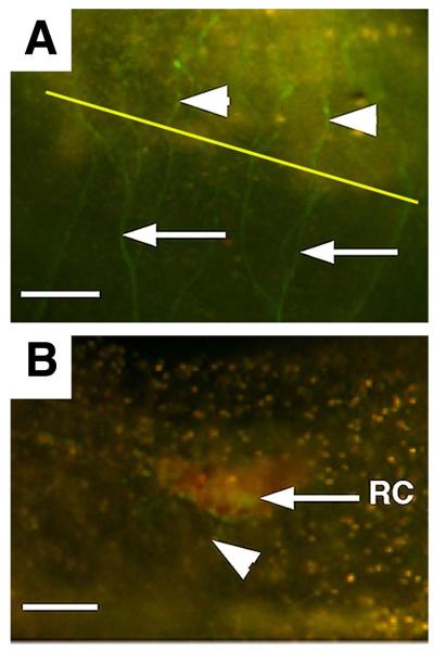 Fig. 11