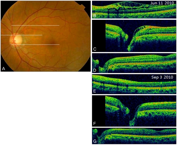 Fig. 4