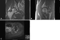Fig. 1A–C