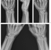 Fig. 1a–d