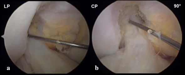 Fig. 1