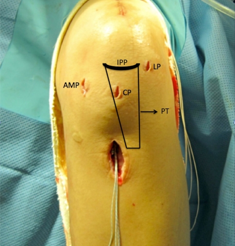 Fig. 2