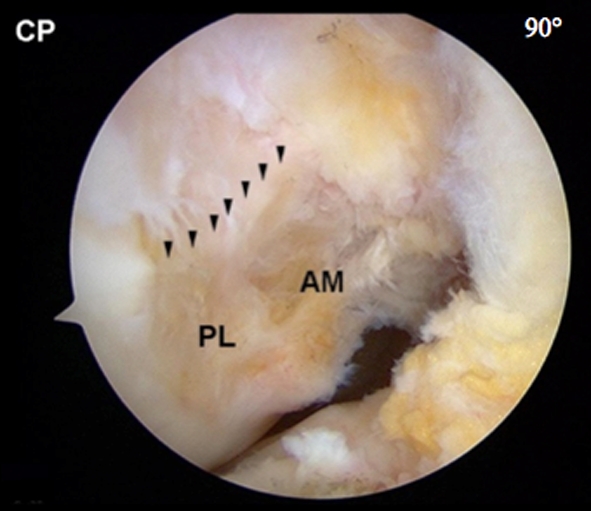 Fig. 4