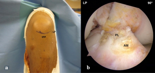 Fig. 3