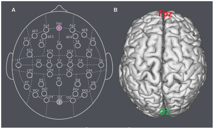 FIGURE 1