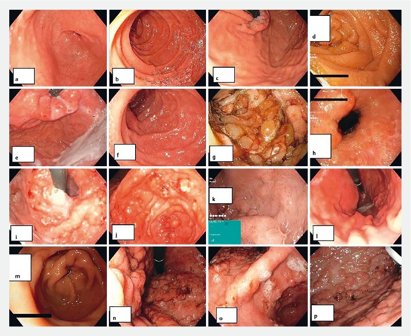 Fig. 1