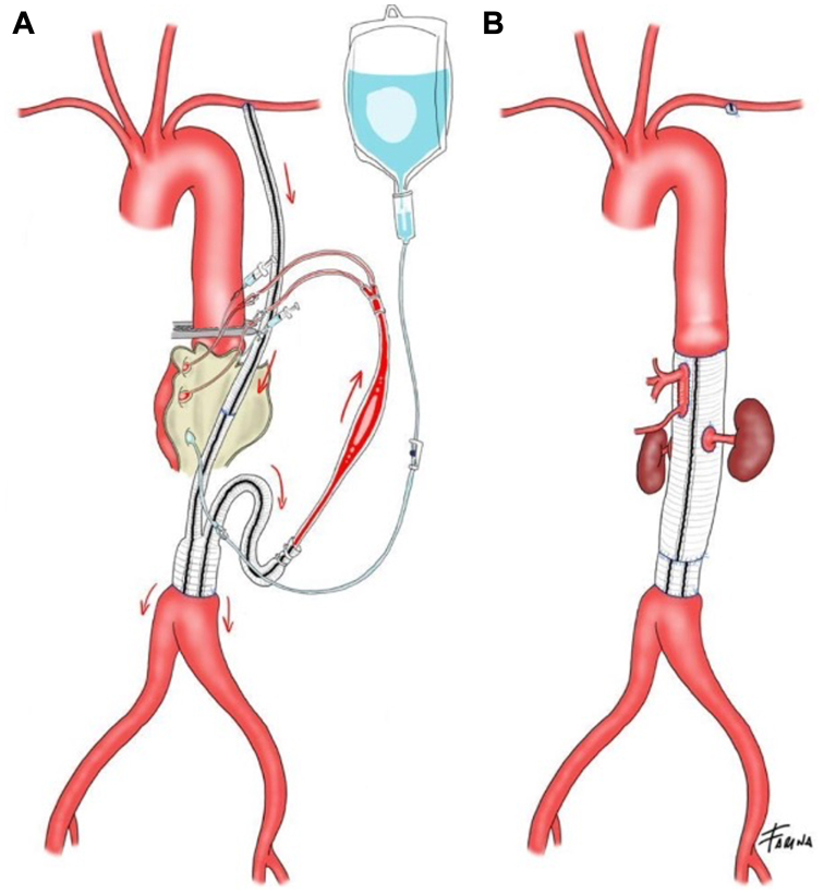 Fig 2