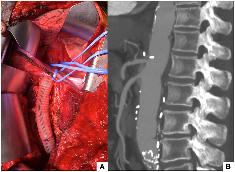 Fig 4