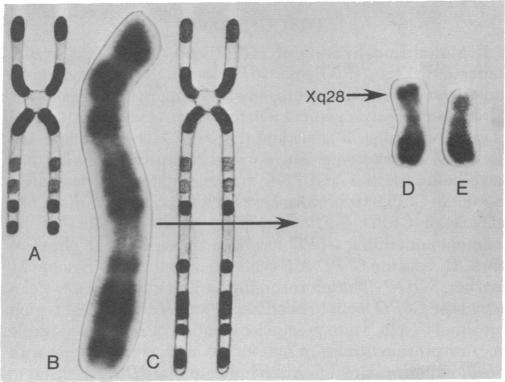 graphic file with name pnas00492-0466-c.jpg