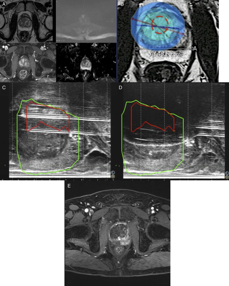 Figure 4