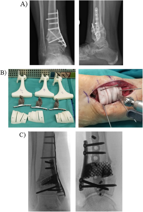 Fig. 4