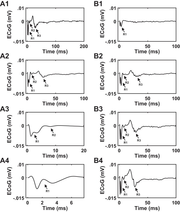 Fig. 11.