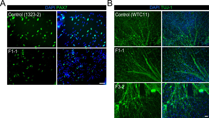 Figure 2—figure supplement 1.