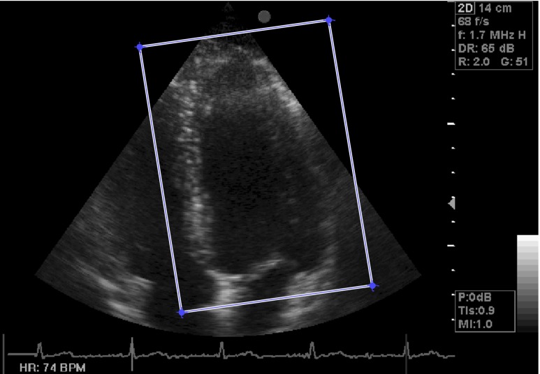 Fig. 3