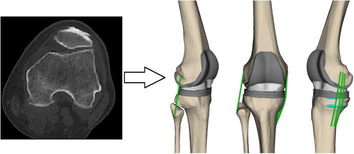Figure 1