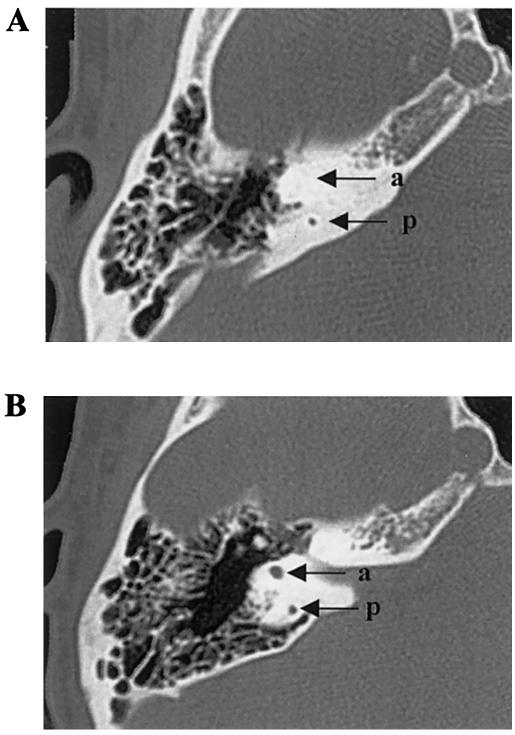 Figure  2