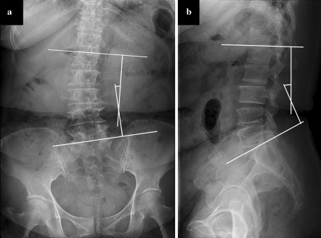 Fig. 1