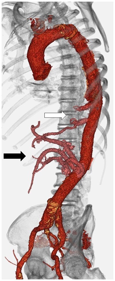 Figure 2: