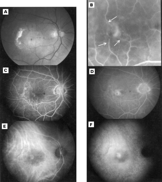 Figure 2  