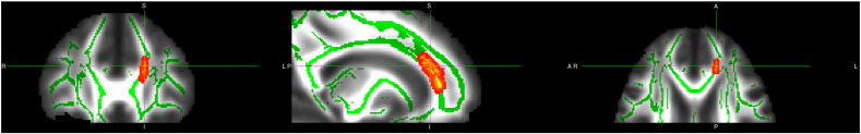 Fig. 1