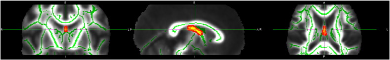 Fig. 2