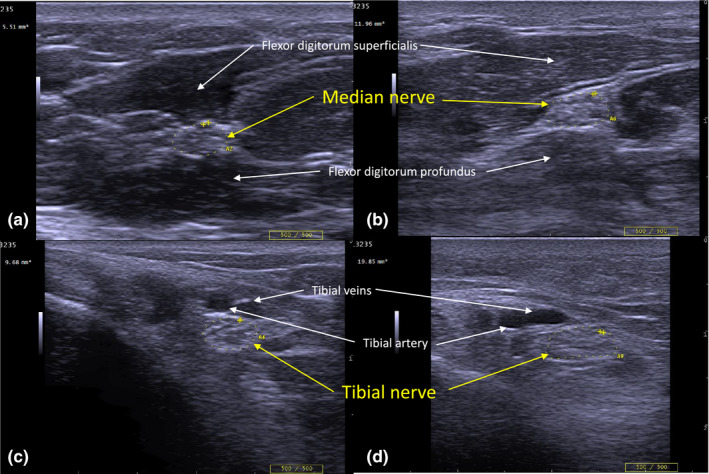 FIGURE 2