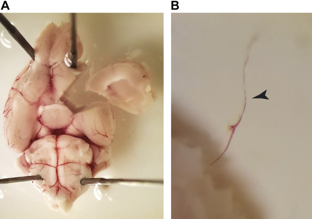 Figure 12.