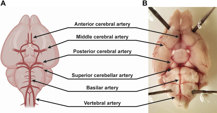 Figure 11.