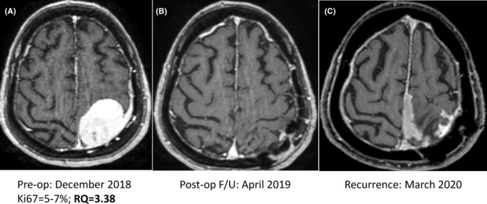 FIGURE 3