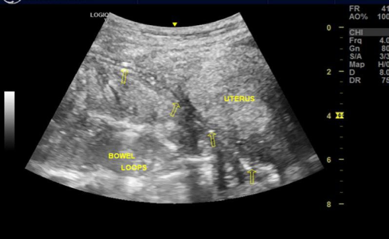 Figure 3b: