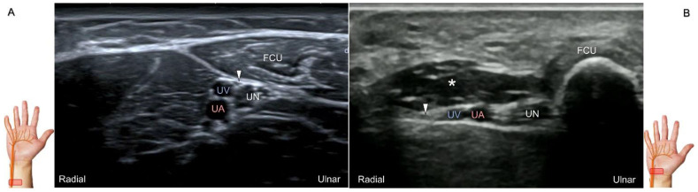 Figure 18