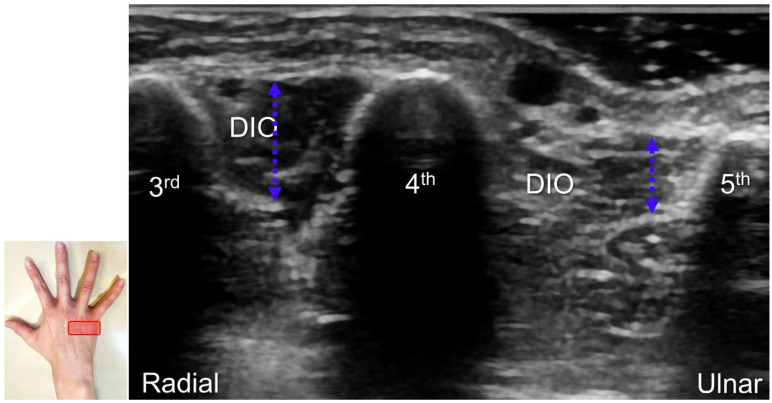 Figure 16