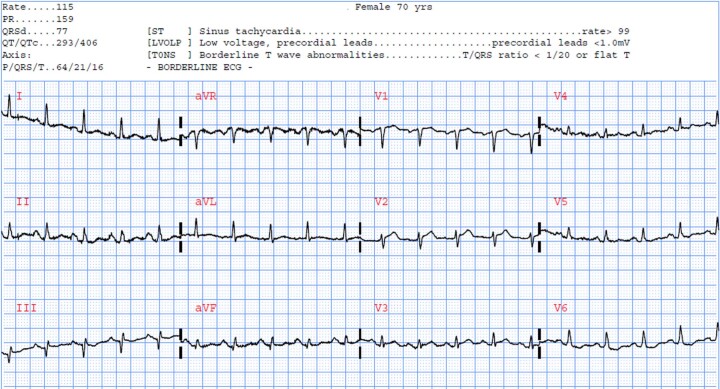 Extended Data Fig. 5