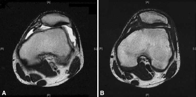 Fig. 2A–B