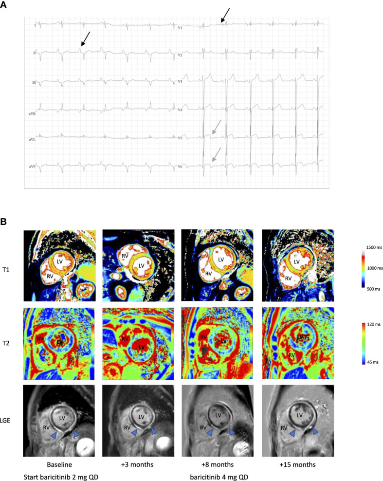 Figure 2