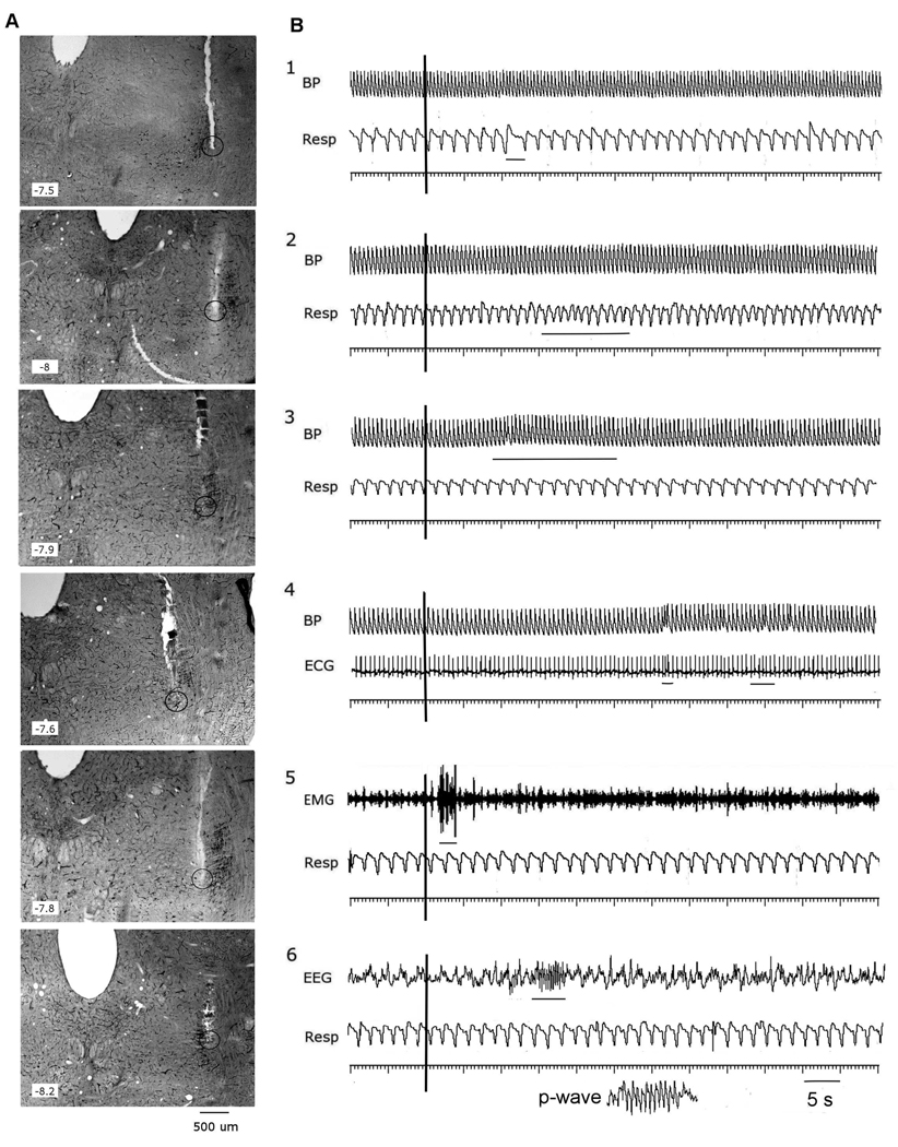 Fig1