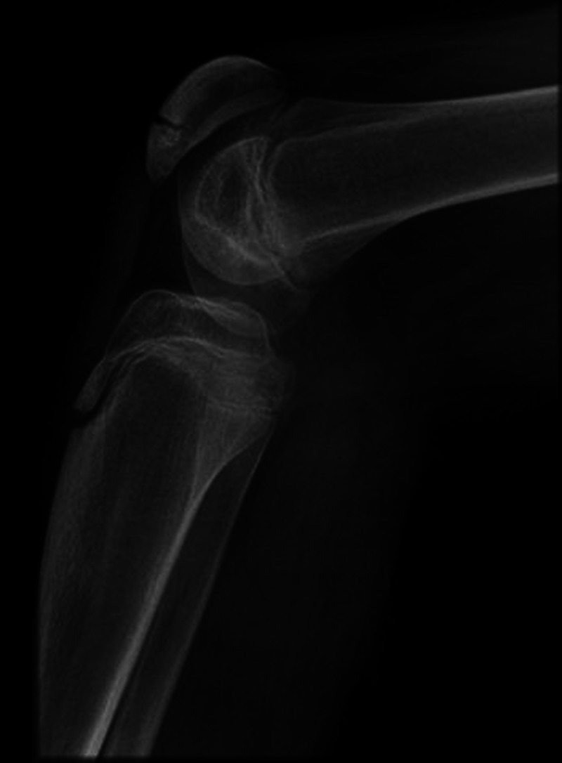 Figure 2
