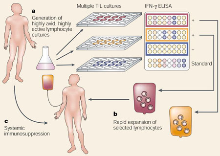 Box 1 | Adoptive-cell-transfer therapy for patients with cancer