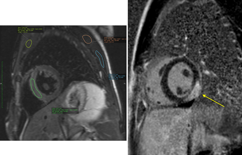 Figure 46.