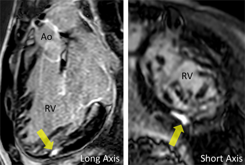 Figure 42.