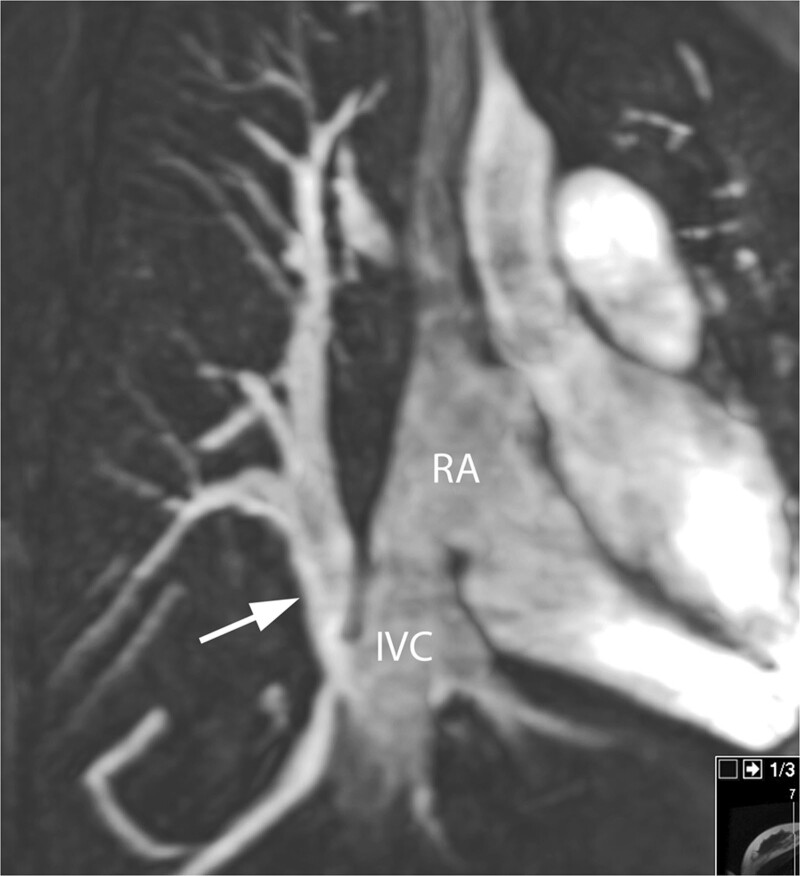 Figure 16.