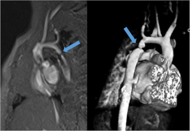 Figure 25.