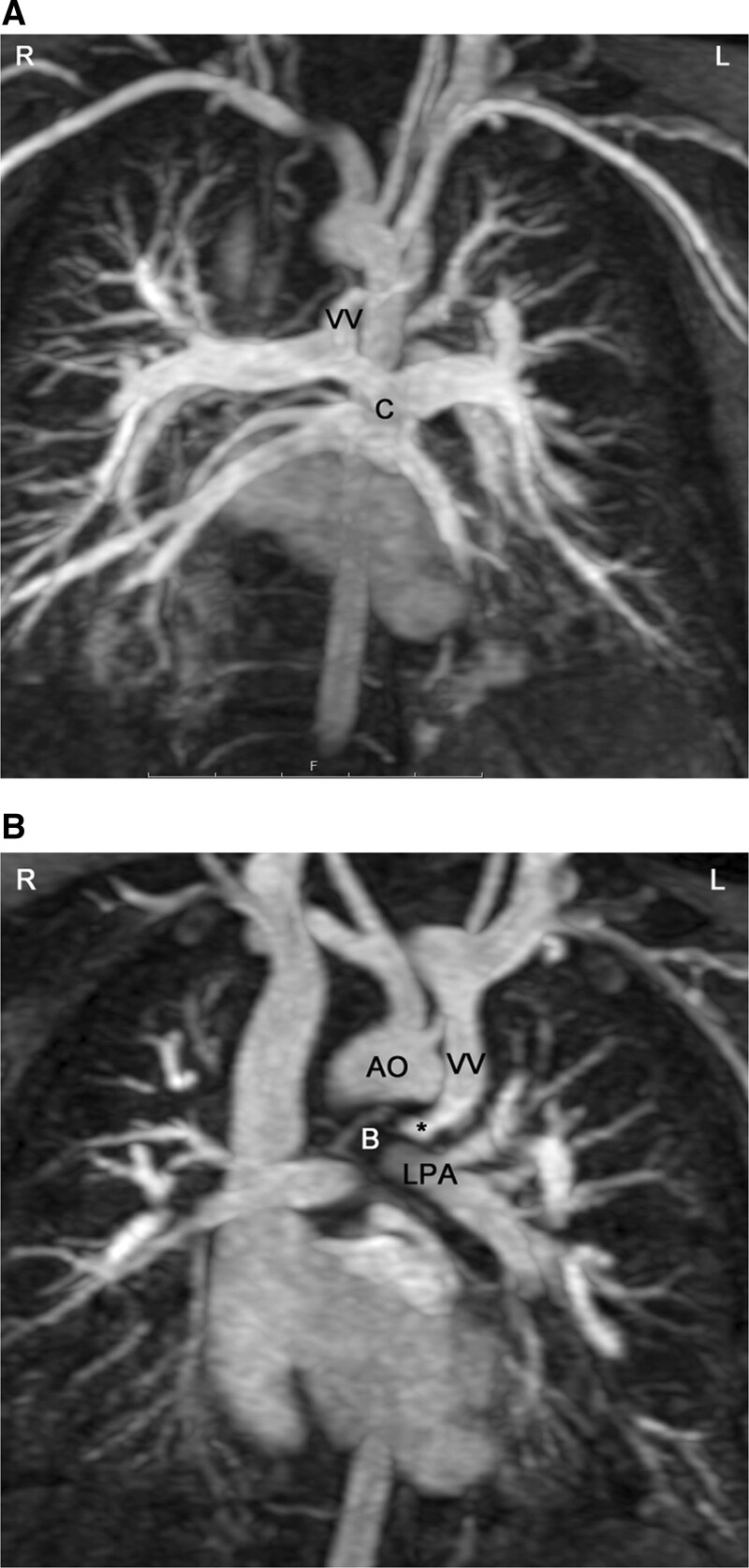 Figure 17.